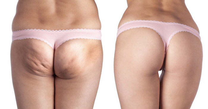 Бразильская попка. До и после